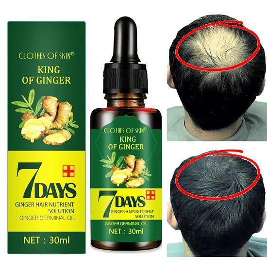 Clothes of Skin King of Ginger Hair Nutrient Solution (30 ml)